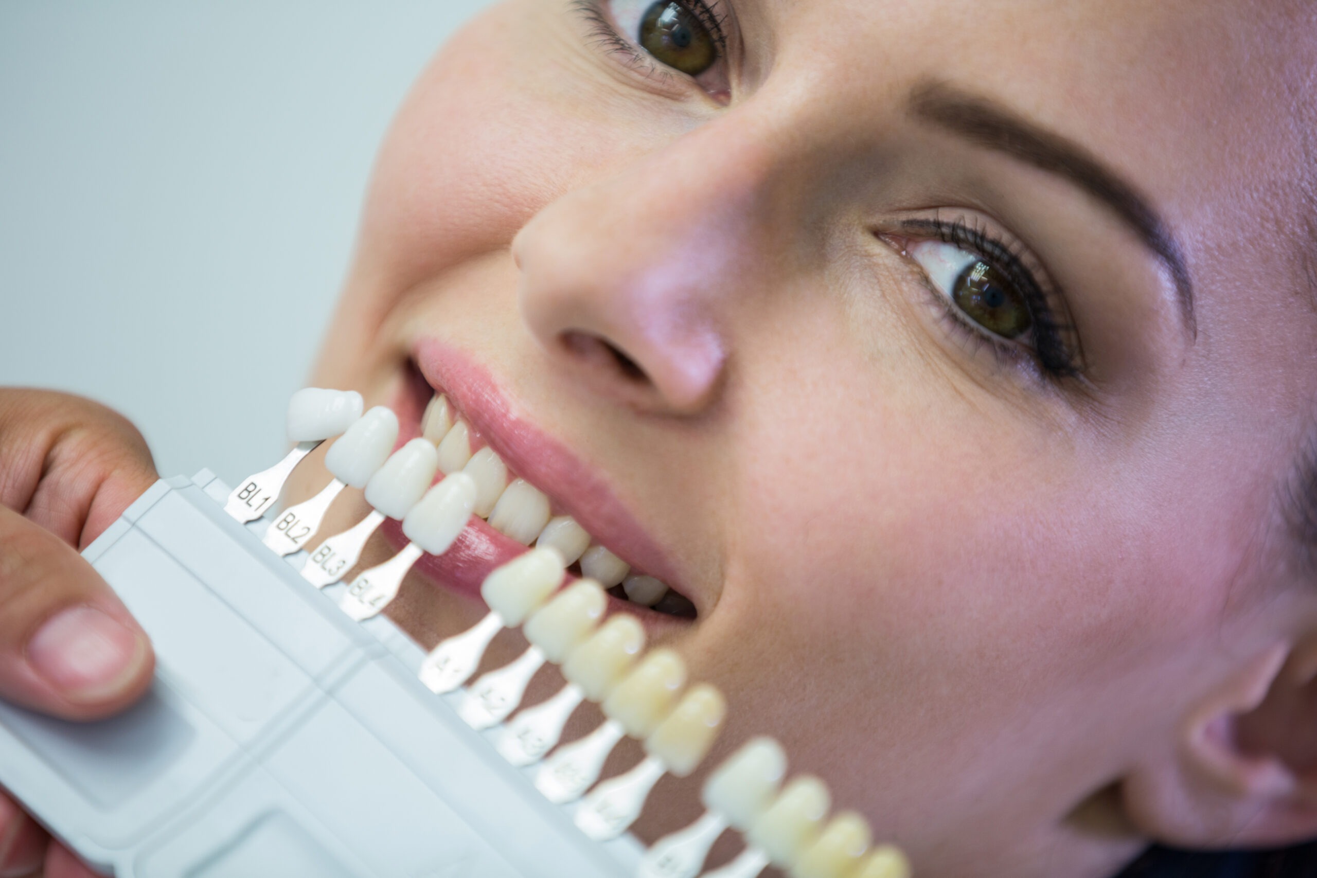 Professionelles veneers in der Praxis von Dra. Leticia